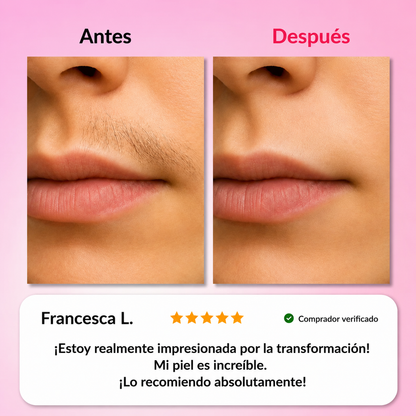 El primer kit completo de 3 fases que debilita y disuelve el vello hormonal sin dolor ni irritaciones