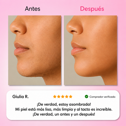 El primer kit completo de 3 fases que debilita y disuelve el vello hormonal sin dolor ni irritaciones