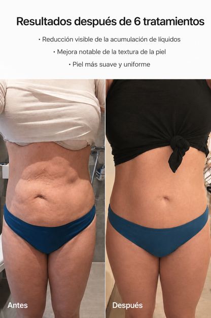 AVELYA – Piel más lisa en 14 días