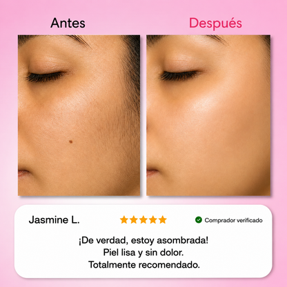 El primer kit completo de 3 fases que debilita y disuelve el vello hormonal sin dolor ni irritaciones