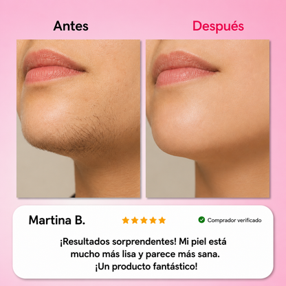 El primer kit completo de 3 fases que debilita y disuelve el vello hormonal sin dolor ni irritaciones